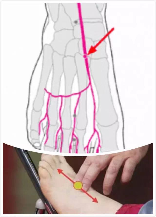 足背动脉的准确位置图片