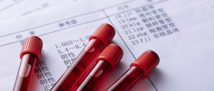 摄图网_501168051_wx_采血管（企业商用）.jpg