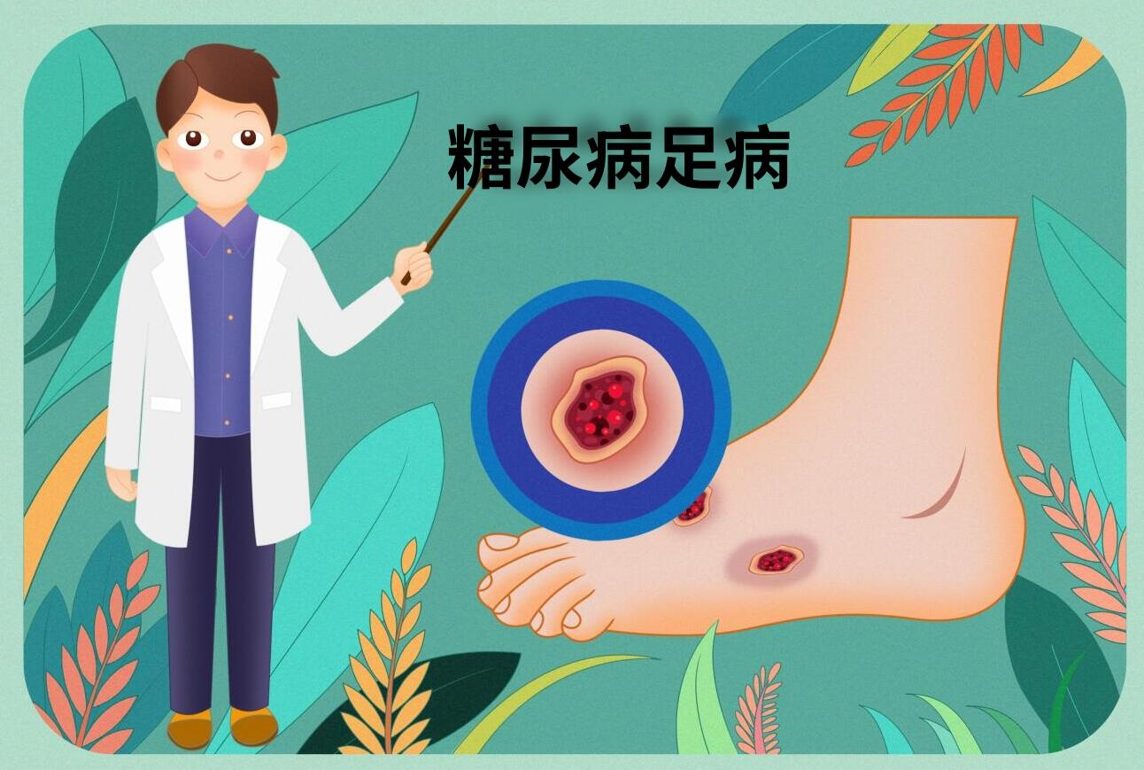 摄图网_401865897_<strong>糖尿病</strong>并发症<strong>糖尿病</strong>足医疗插画（企业商用）_副本.jpg